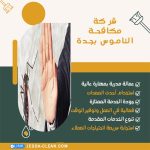 شركة مكافحة الناموس بجدة